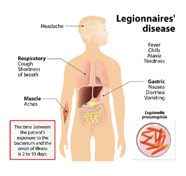 Reduzca Riesgos: Legionela, la bacteria MORTAL 